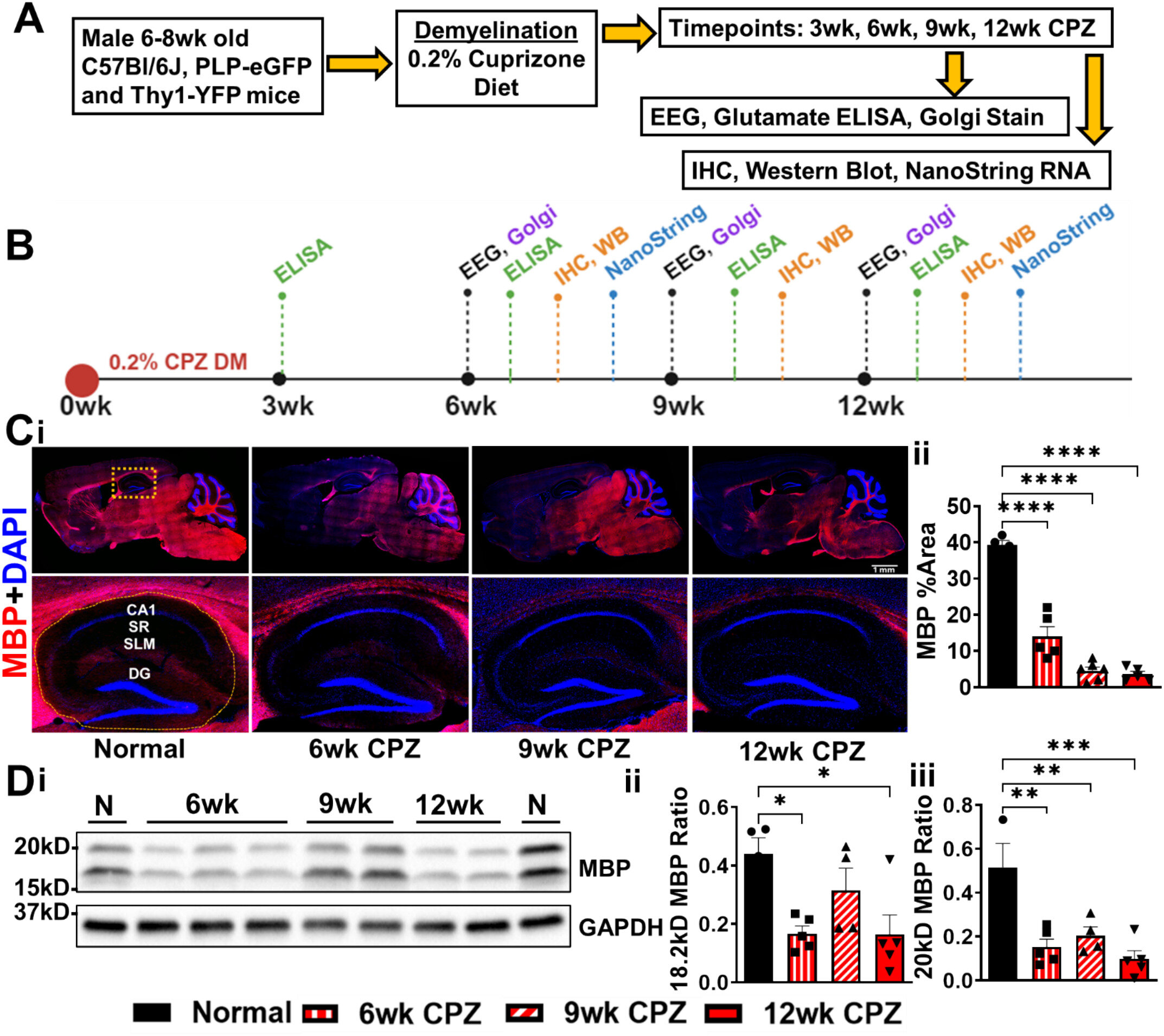 Comment les dommages causés par la myéline du cerveau peuvent entraîner des convulsions dans la SEP