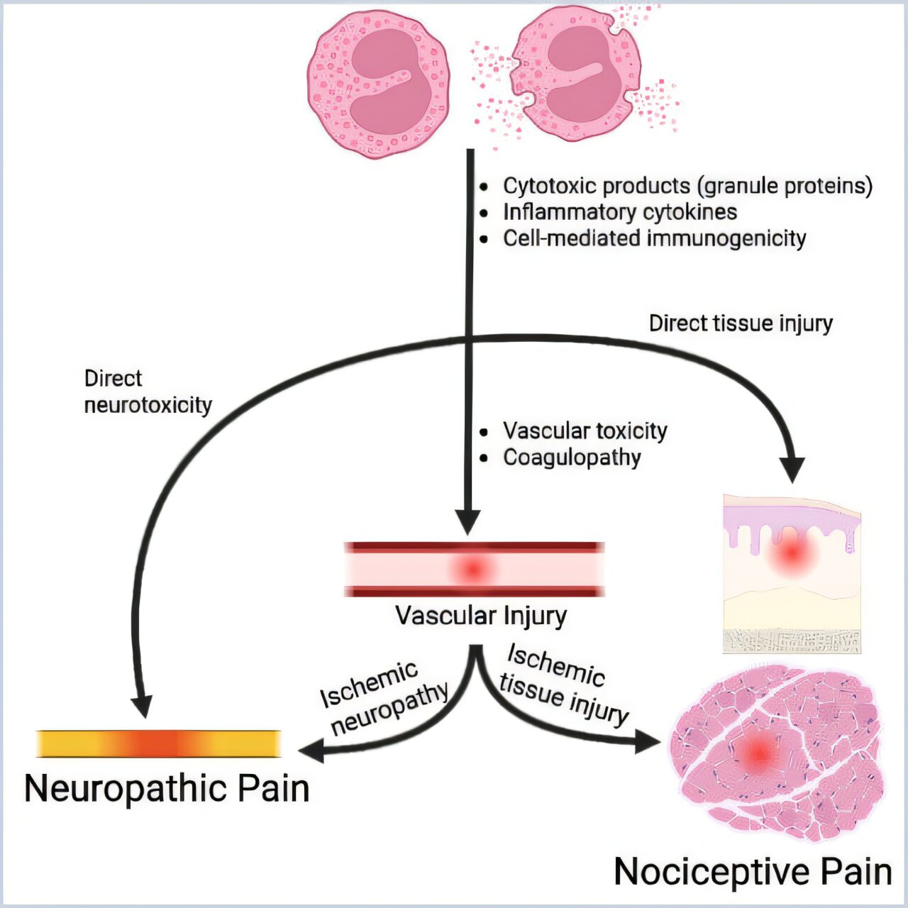 Lien potentiel entre la douleur chronique et la maladie immunitaire découvert