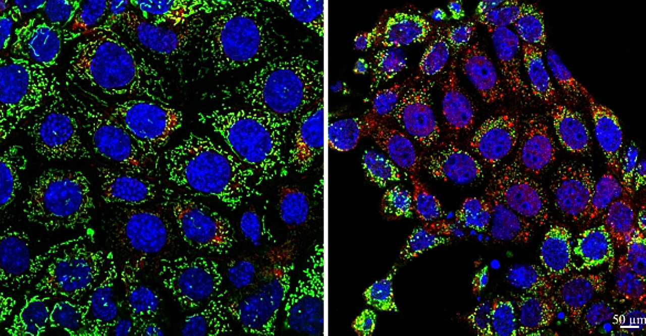 Les mutations de l'ADN mitochondrial dues aux facteurs de stress rénaux peuvent aider à prédire le futur déclin des organes
