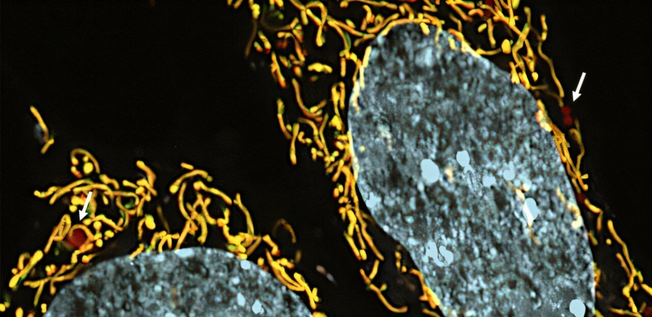 La recherche révèle la possibilité d’un nouveau traitement médicamenteux pour les maladies héréditaires