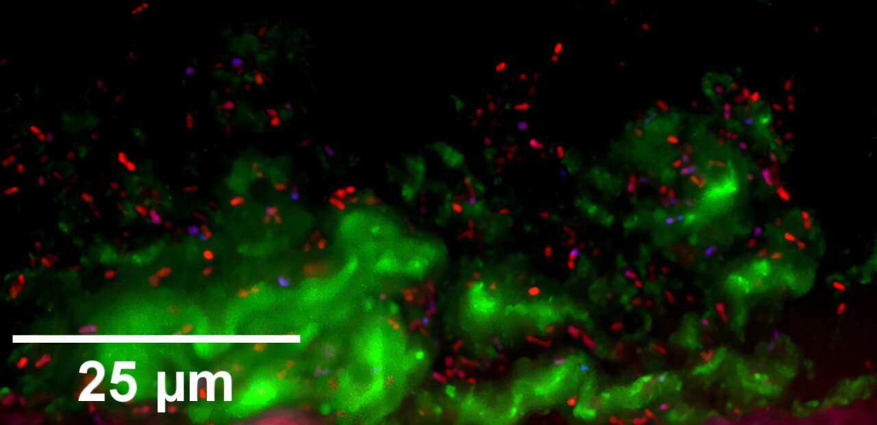 Des modèles de nez miniatures pourraient aider à prévenir les infections et à promouvoir la santé nasale