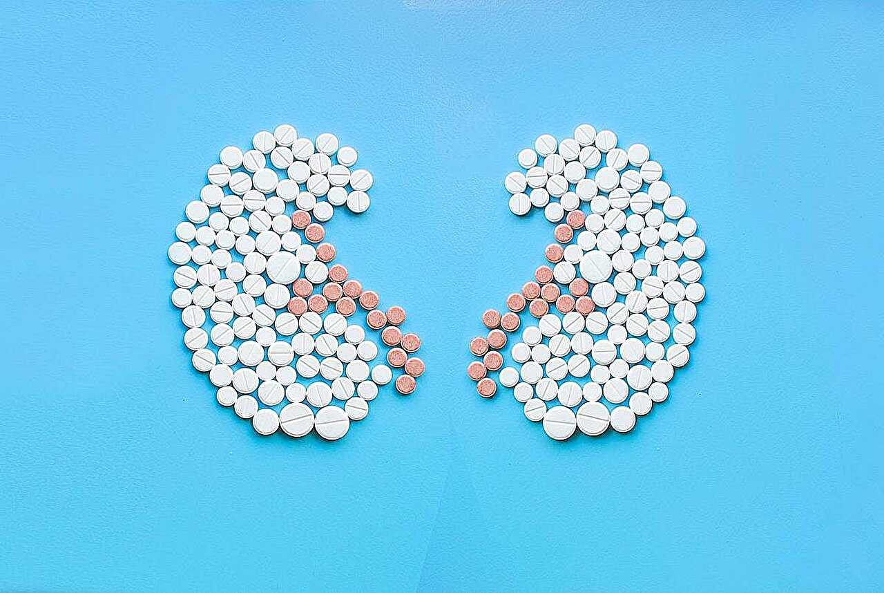 La prévalence de l’insuffisance rénale chronique est élevée chez les patients atteints d’hépatite B chronique