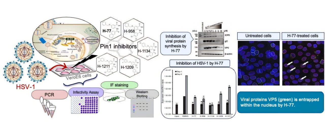 De nouveaux antiviraux pourraient aider à prévenir les boutons de fièvre en modifiant les structures cellulaires