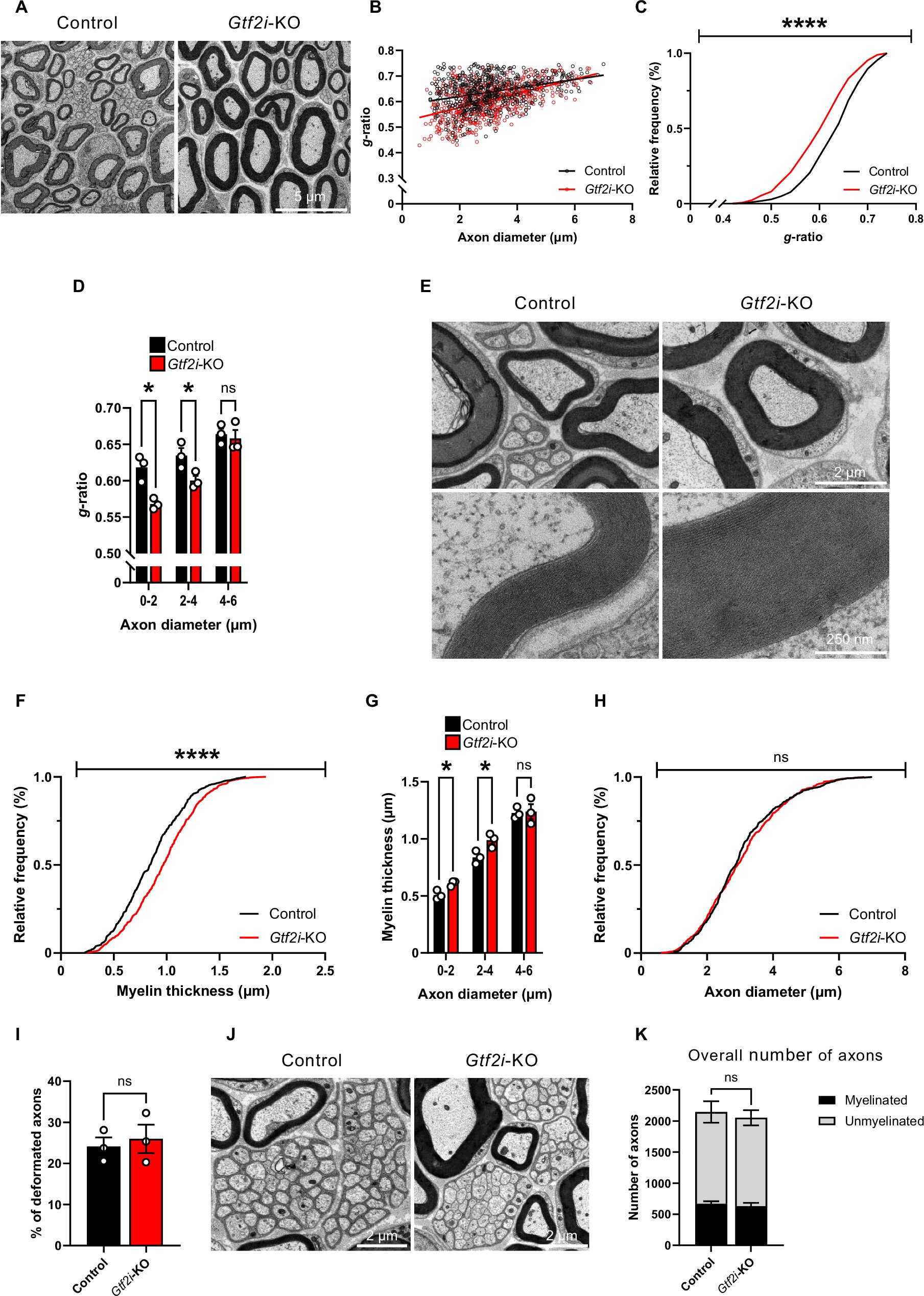 Un mécanisme biologique qui stimule la production de myéline dans le cerveau pourrait faciliter le traitement des troubles neurologiques
