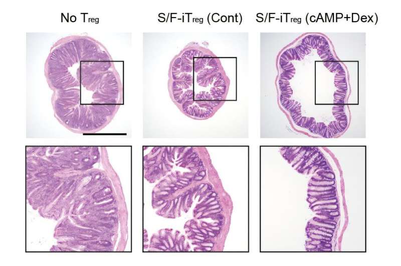 Des expériences réussies reprogramment des cellules T indésirables pour une thérapie ciblée contre les maladies auto-immunes
