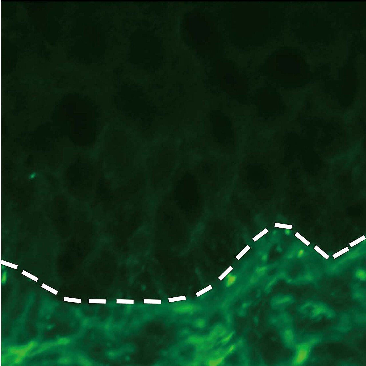 Des expériences réussies reprogramment des cellules T indésirables pour un traitement ciblé des maladies auto-immunes