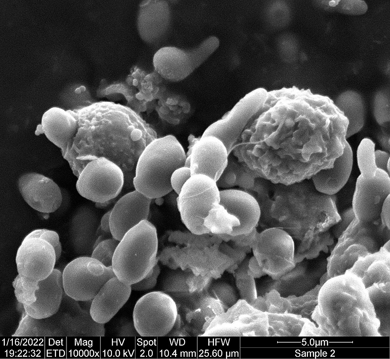 Les cellules immunitaires liées aux allergies peuvent servir de défenseurs contre les infections à Candida