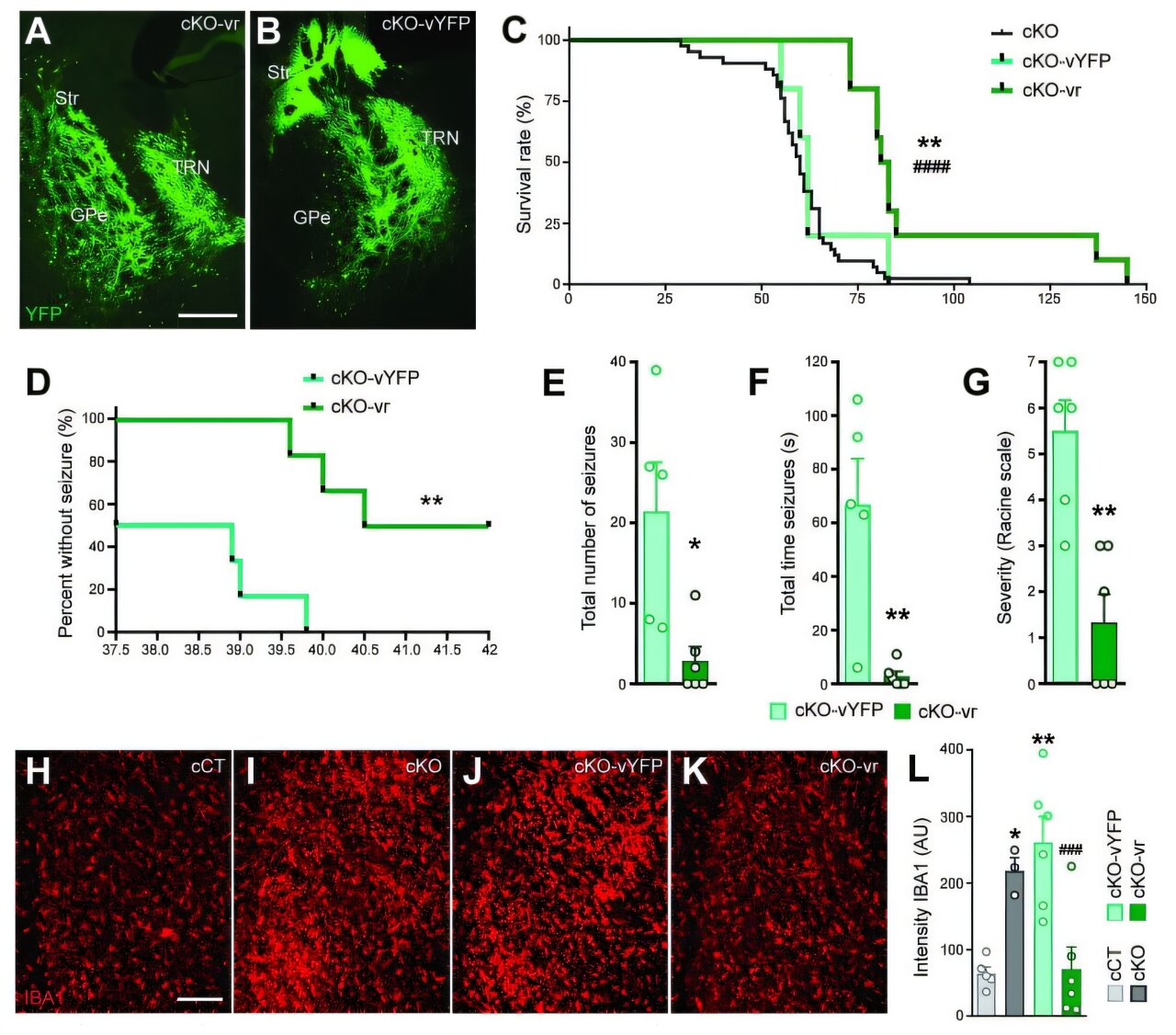 L'épilepsie mitochondriale pourrait provenir d'un groupe spécifique de neurones cérébraux