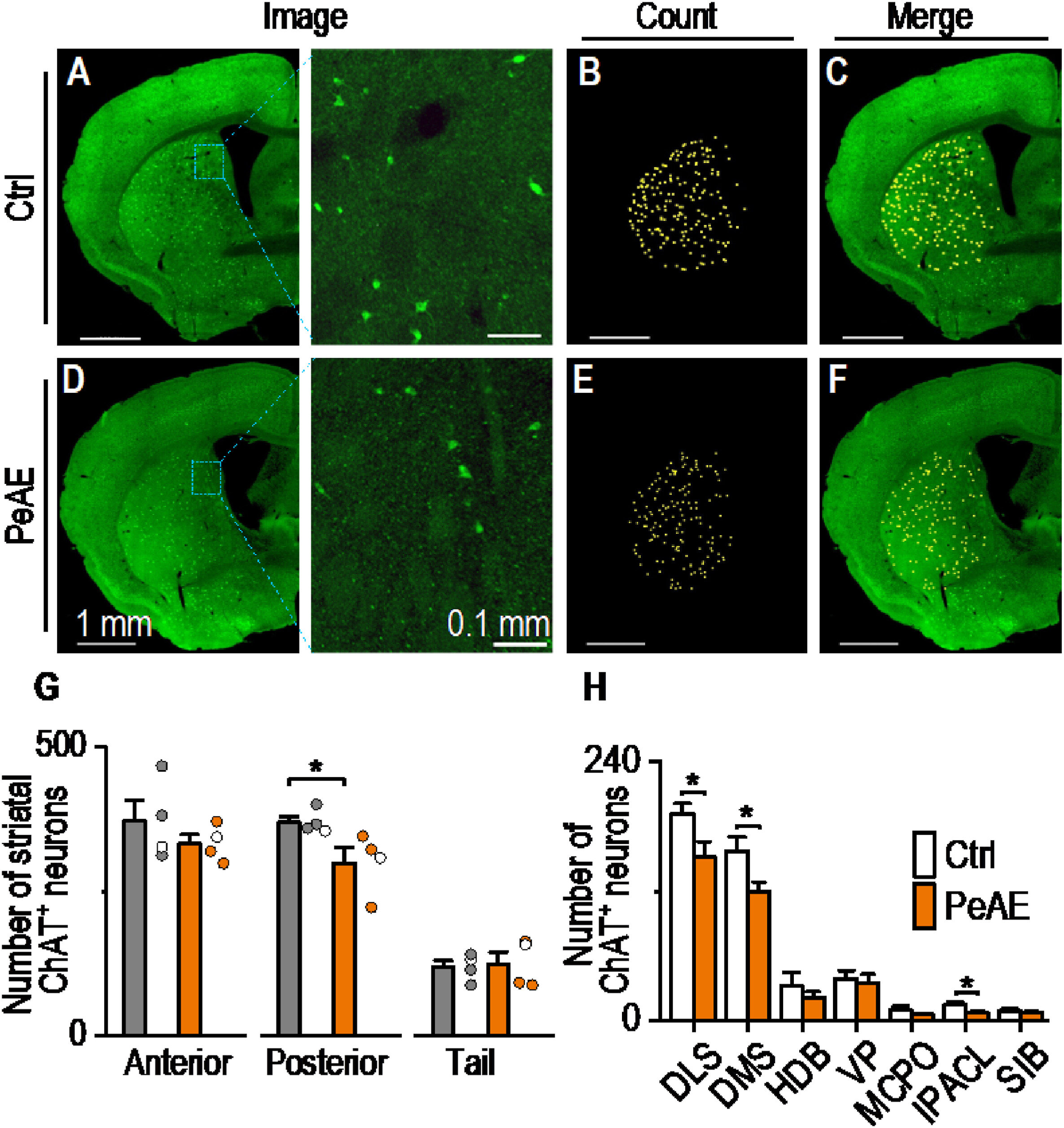 L'exposition prénatale à l'alcool recâble le cerveau et alimente les comportements compulsifs, selon une nouvelle étude