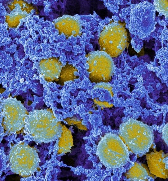 Un essai clinique montre l’efficacité de la thérapie bactériophage contre la bactériémie à Staphylococcus aureus