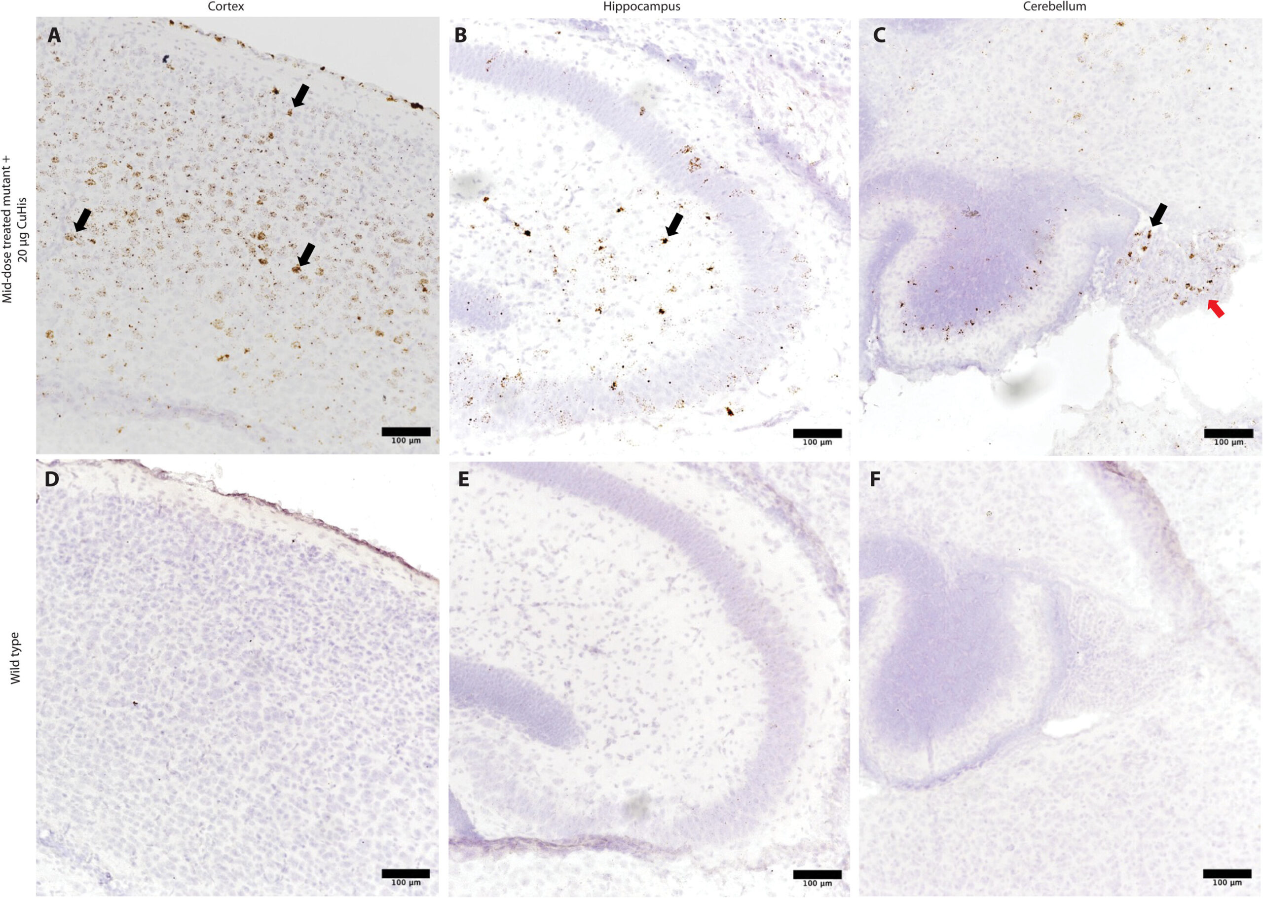 La thérapie génique peut offrir un nouvel espoir aux nourrissons atteints d'une maladie rare et mortelle