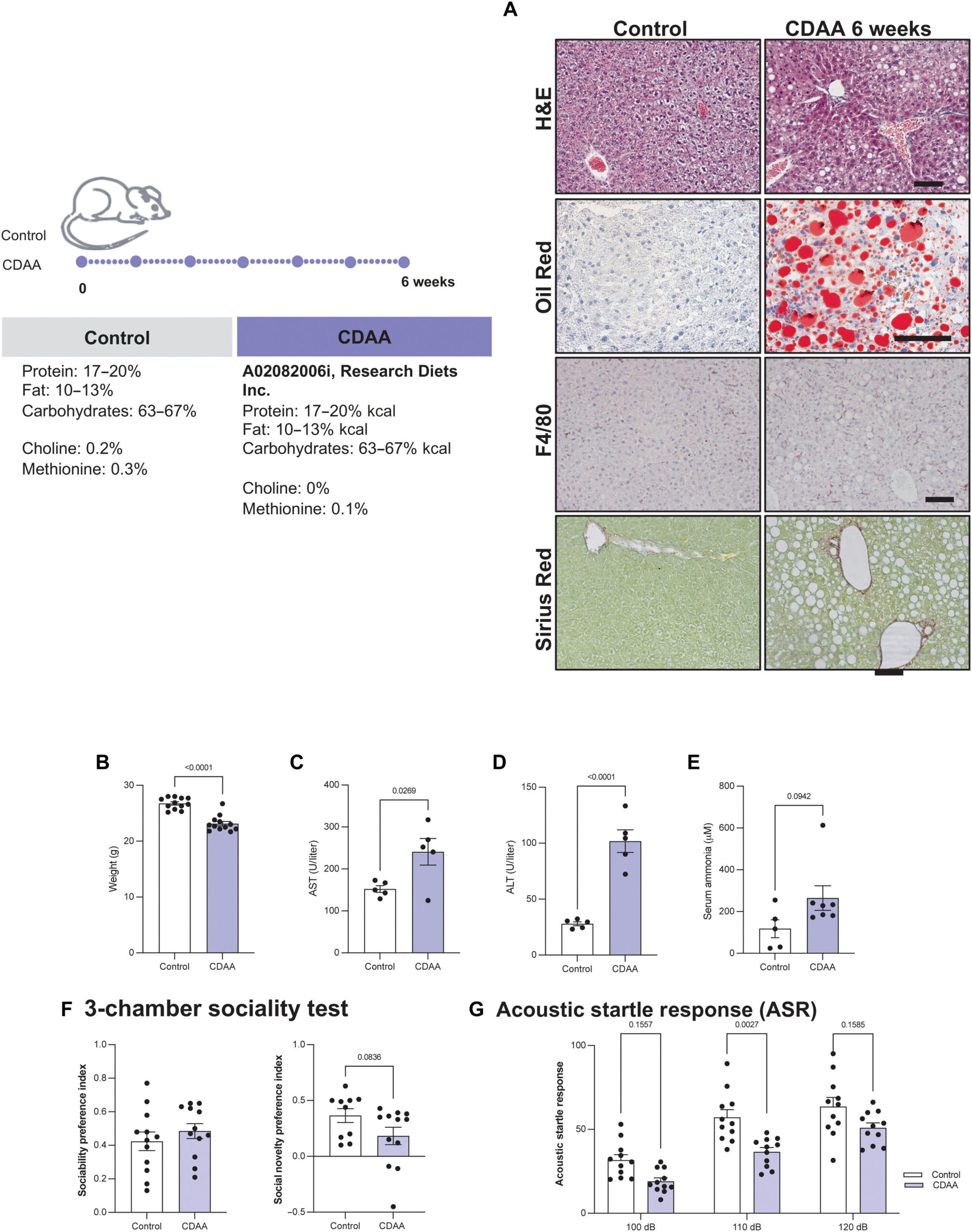 Le lien entre le foie et le cerveau dans le contexte d’une maladie métabolique du foie révélé