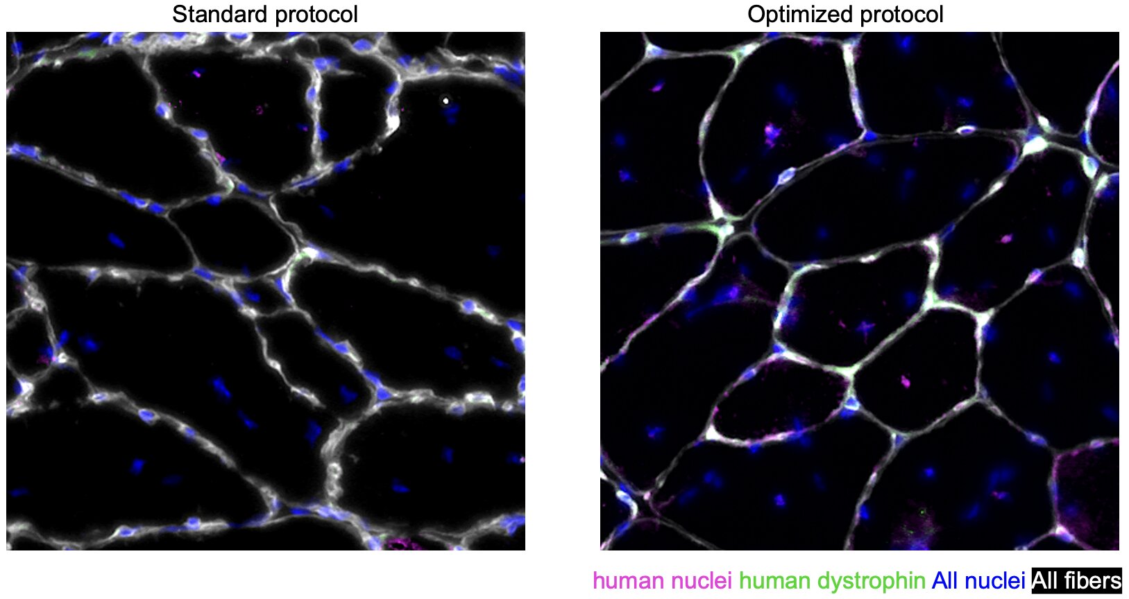 Le blocage d'une protéine clé peut doubler le rendement et augmenter la puissance des cellules régénératrices musculaires