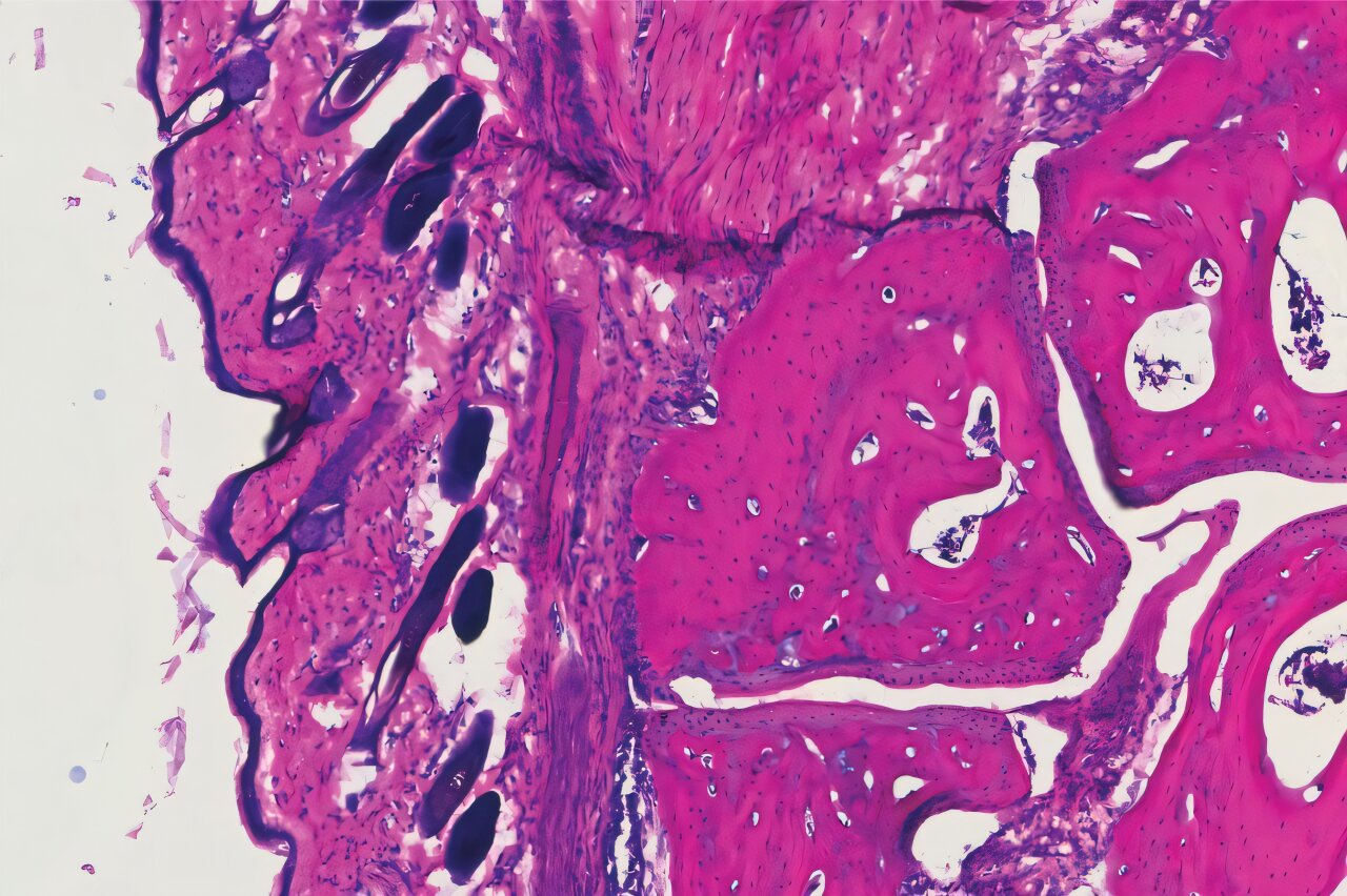 Un nouvel anticorps fabriqué en laboratoire correspond à l’efficacité des IgIV à des doses plus faibles chez la souris