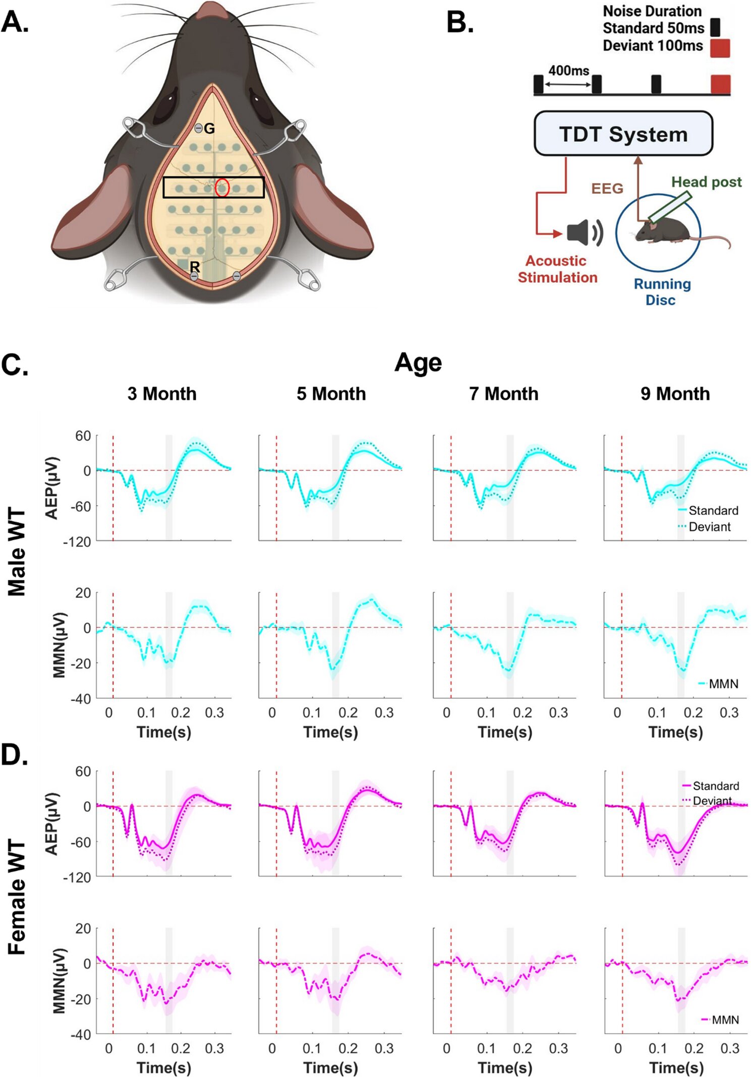 Forme du sexe et de l’âge Progression de la maladie de Batten, selon une étude sur les ondes cérébrales