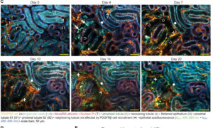 Identification d’un marqueur prédictif de la mort cellulaire dans les reins