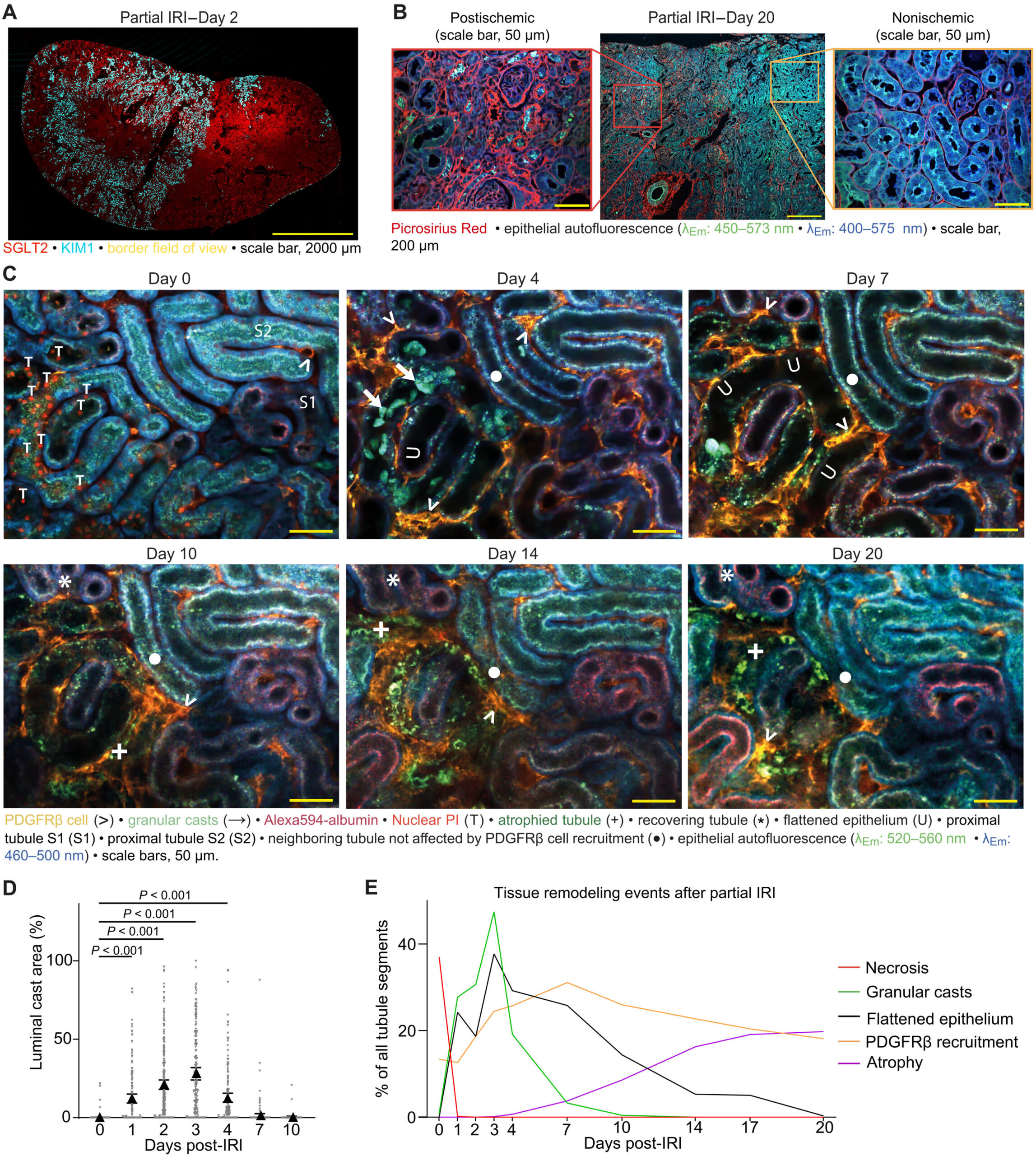 Identification d'un marqueur prédictif de la mort cellulaire dans les reins