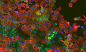 La réplication du coronavirus repose sur une enzyme hôte nouvellement identifiée, selon une étude