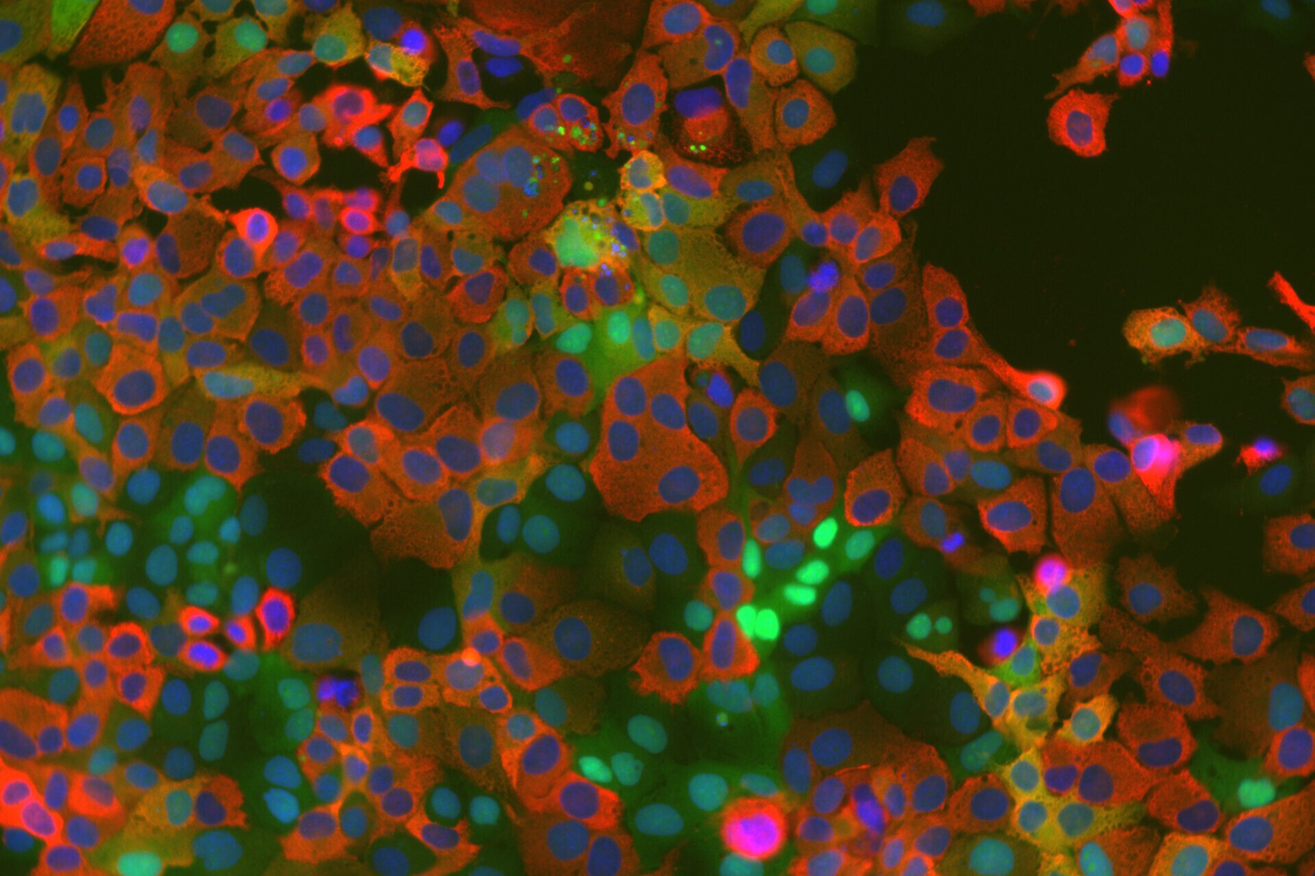 La réplication du coronavirus repose sur une enzyme hôte nouvellement identifiée, selon une étude