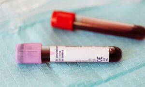 Un désaccord entre deux tests de la fonction rénale prédit de graves problèmes de santé