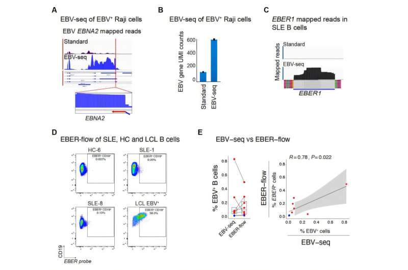 Les scientifiques associent le lupus à un virus que nous sommes presque tous porteurs