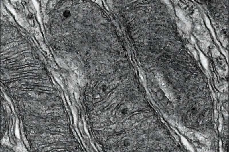 Un nouveau médicament protège les mitochondries et prévient les lésions rénales chez la souris