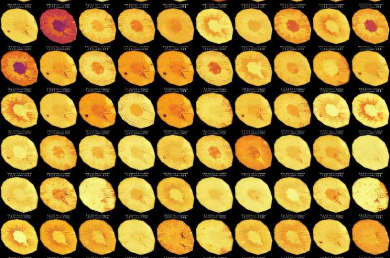 Un nouveau médicament protège les mitochondries et prévient les lésions rénales chez la souris