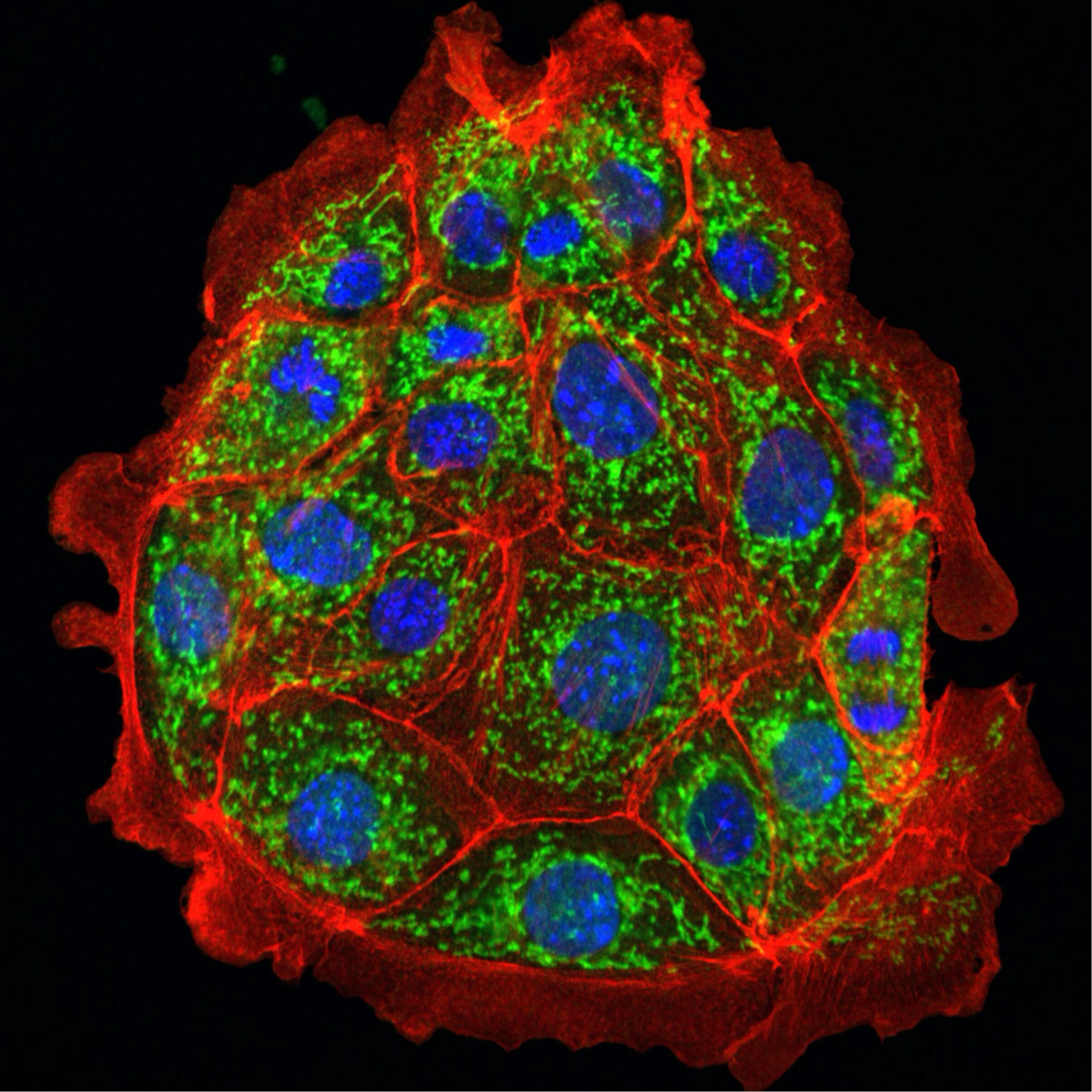 Un médicament expérimental protège les mitochondries et prévient les lésions rénales chez la souris