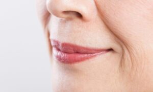 Dites adieu aux rides autour de la bouche : le guide ultime avec les meilleurs conseils d’experts pour une peau ultra lisse et visiblement plus jeune