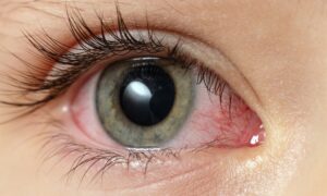 Les ordinateurs et les téléphones portables mettent vos yeux à rude épreuve – c&rsquo;est ainsi que vous éviterez les dommages