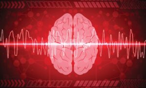 Cinq signes avant-coureurs annoncent un accident vasculaire cérébral des semaines à l’avance