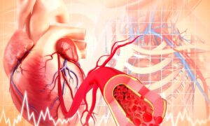 Les 5 règles les plus importantes pour se protéger contre une crise cardiaque