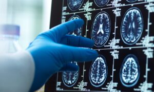 29 Les maladies et les blessures augmentent votre risque de démence