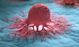 Les personnes mariées sont moins susceptibles d&rsquo;avoir un cancer – en particulier 2 types