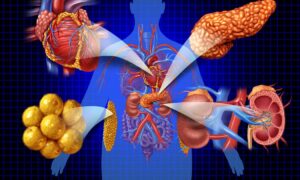 Lorsque le cœur et les reins souffrent, le risque de cancer augmente