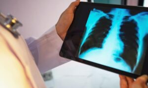 Risque de BPCO lié à l&rsquo;alimentation ? Ce que les scientifiques étudient désormais plus en détail