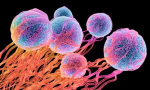 Huit risques de cancer que personne ne connaît et qui peuvent être évités