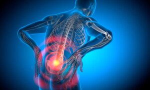Un nouveau médicament vise à soulager les maux de dos chez des millions de personnes