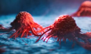 « Cellules zombies » : pourquoi le cancer réapparaît souvent après une chimiothérapie